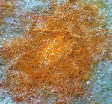 Rust fungus 60x